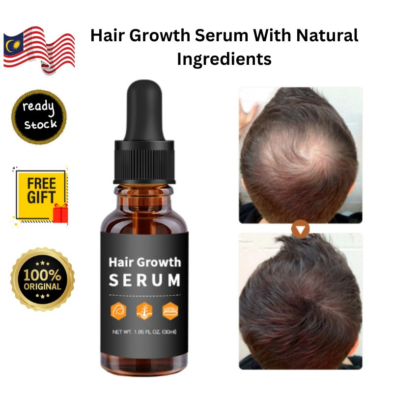 Hair Growth Serum For Receding Hairlines, Anti-Ageing Hair, Hairloss ...