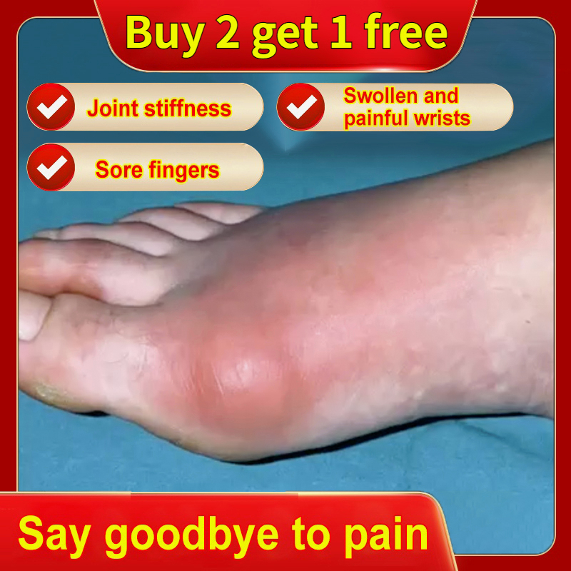 Gout ointment Joint pain 35g Gout Treatment Cream Gout Pain Relief