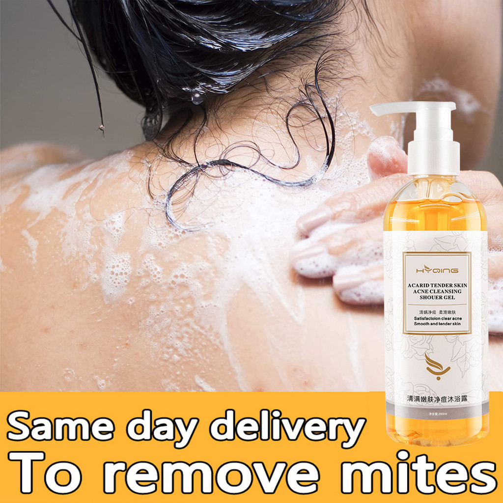 Eczema Kulit Gatal Acne Mites Anti Itch Shower Gel Amino Acid Whitening