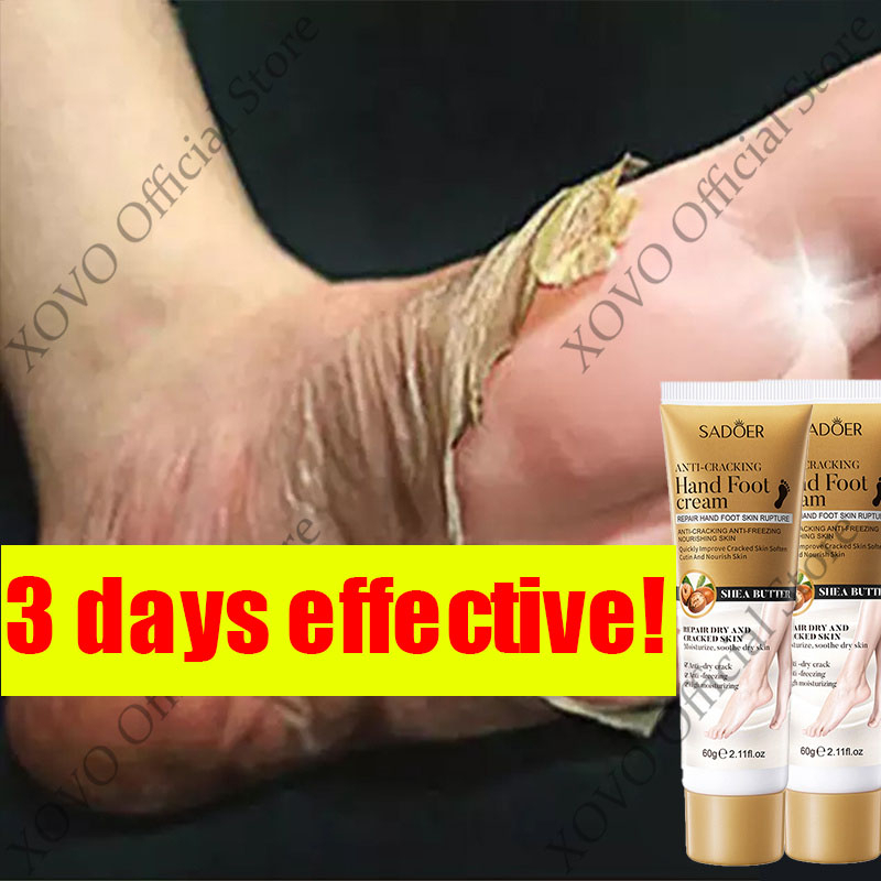 Good foot cream Foot cream medicine for cracked and dry feet Cream for