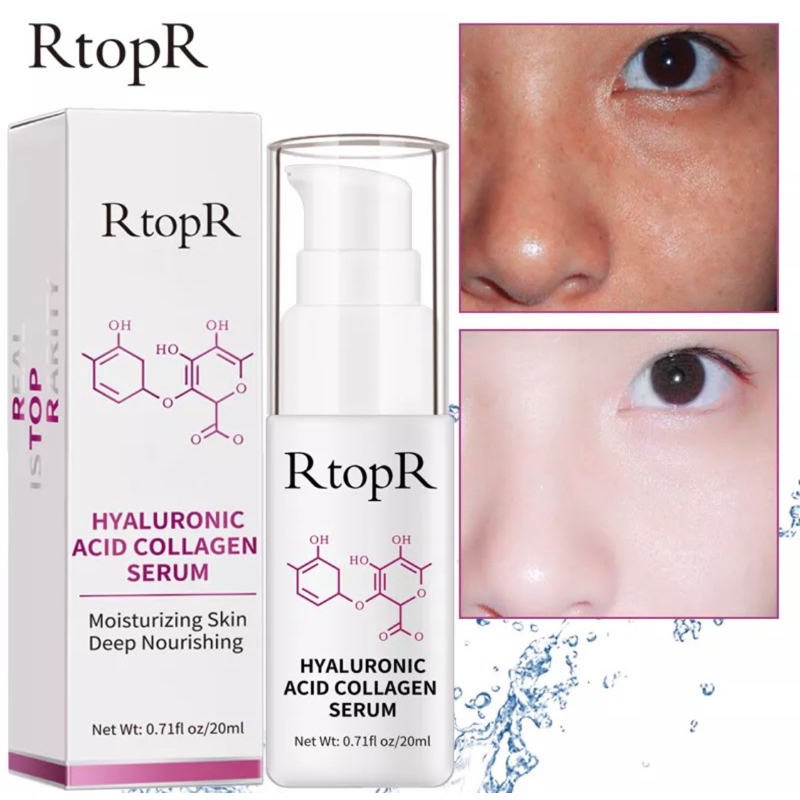 RtopR Hyaluronic Acid Collagen Serum (20ml) Shopee Malaysia