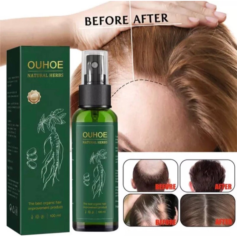 OUHOE NATURAL HERBS HAIR SERUM ANTI HAIR FALL SERUM RAMBUT GUGUR ...