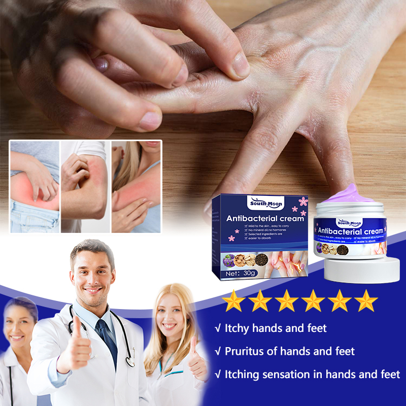 止痒膏 Antiitch cream Itchy hands and feet Pruritus of hands and feet