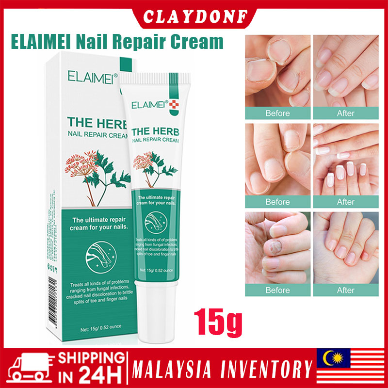 ELAIMEI Nail Repair Cream for Treatment and Nursing of Fungal Disease