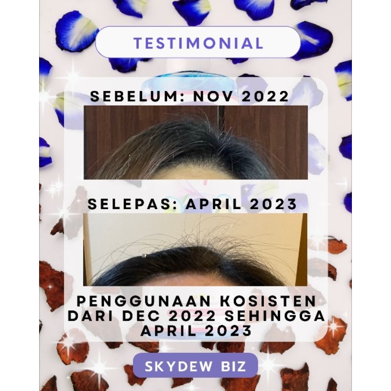 Skydew Flower Shampoo Bunga Telang Shampoo He Shou Wu Pea Protein Hair Growth Shampoo Grey Hair