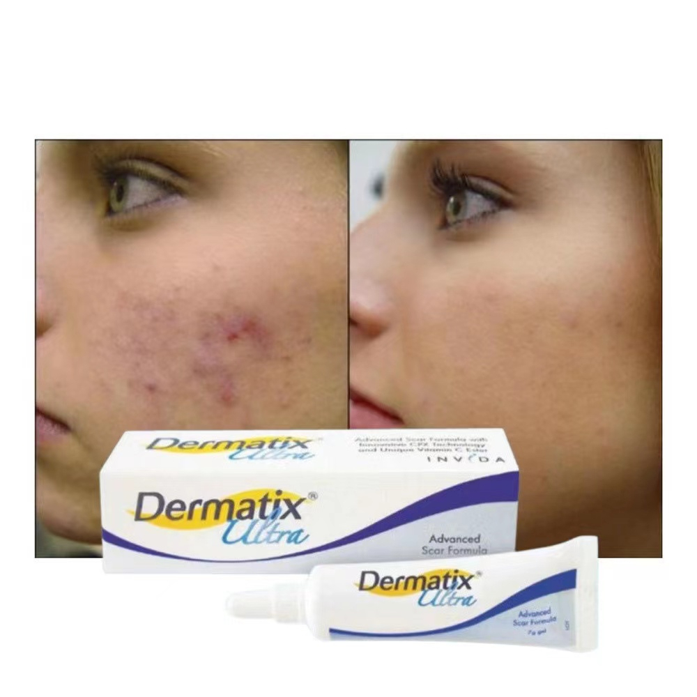 Dermatix Ultra 15g, Original Dermatix Scar Gel, Dermatik Scar Reduction