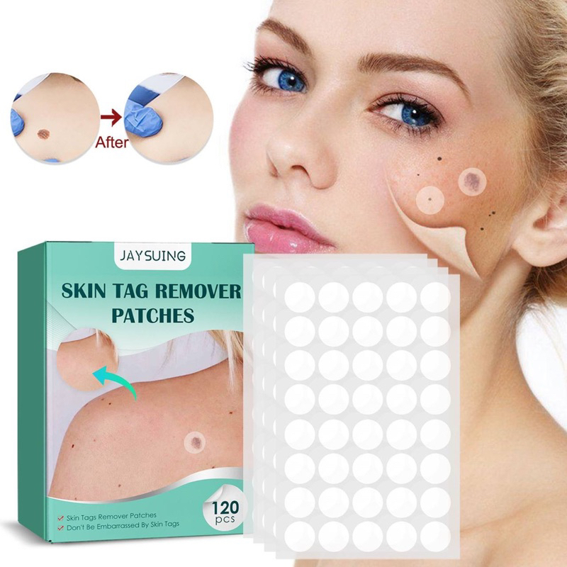 JAYSUING SKIN TAG REMOVER PATCHES buang ketuat kutil jeragat bintik ...