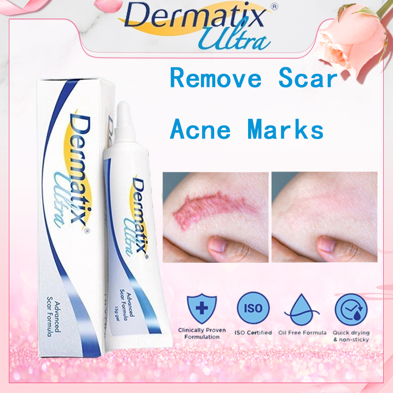 Dermatix Ultra acne scar advance gel scar formula 15g scar silicone gel