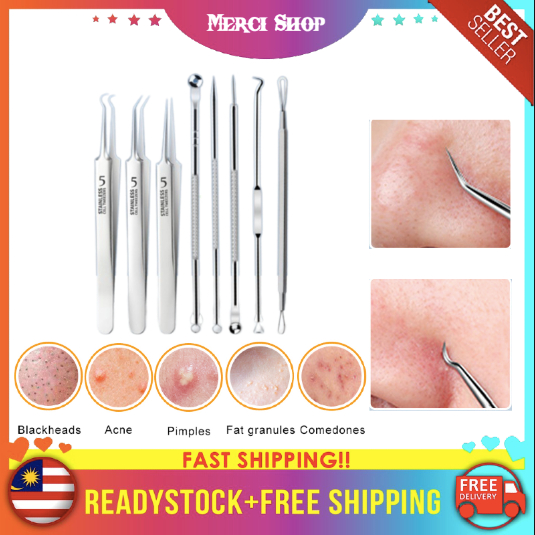 MS Ingrown Pimple Tweezers Acne Blackhead Removal Needles Blackhead