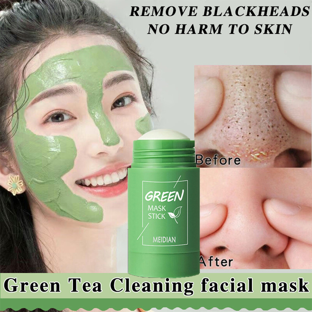 Dermatix Advanced Scar Formula Acne Scar Cream Keloid Scar Remover Krim