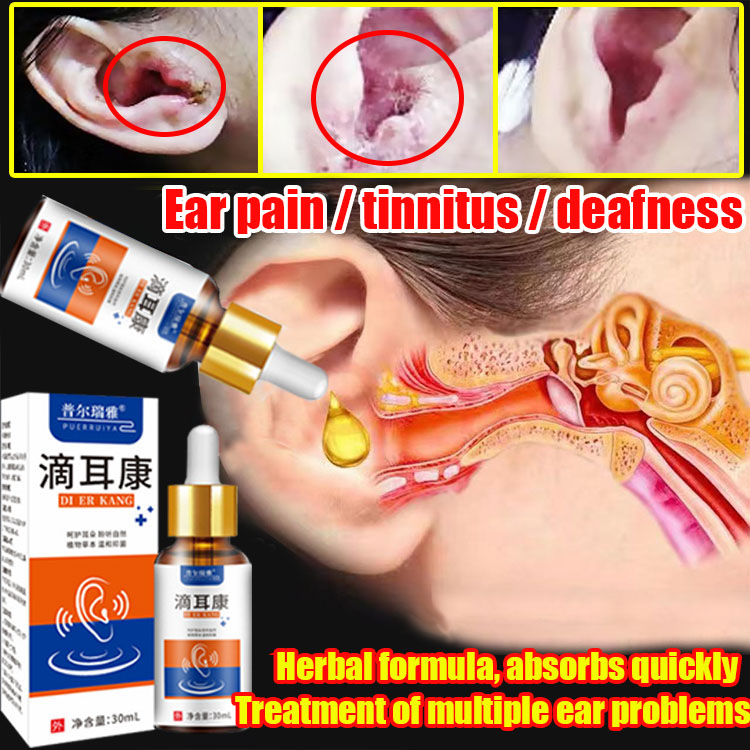 100 Original Earwax Cleanser (30ML) tinnitus ear drops Ear Wax Removal