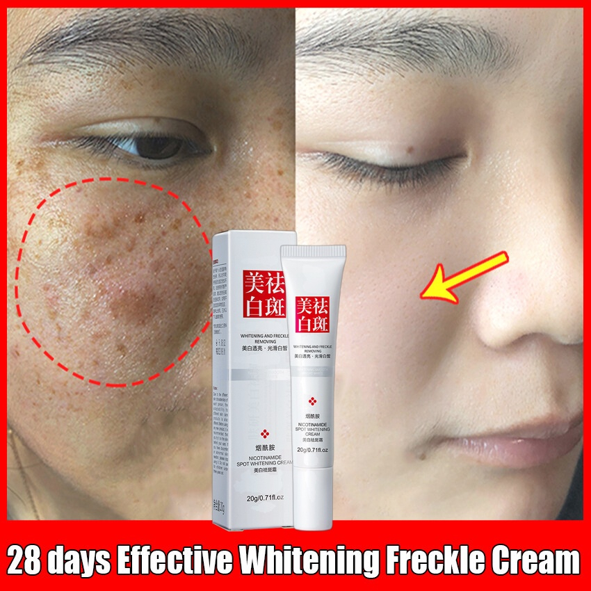 Whitening Freckle Cream Krim Jeragat Remove Melasma Cream Remove Dark Spots Melanin Melasma 6900