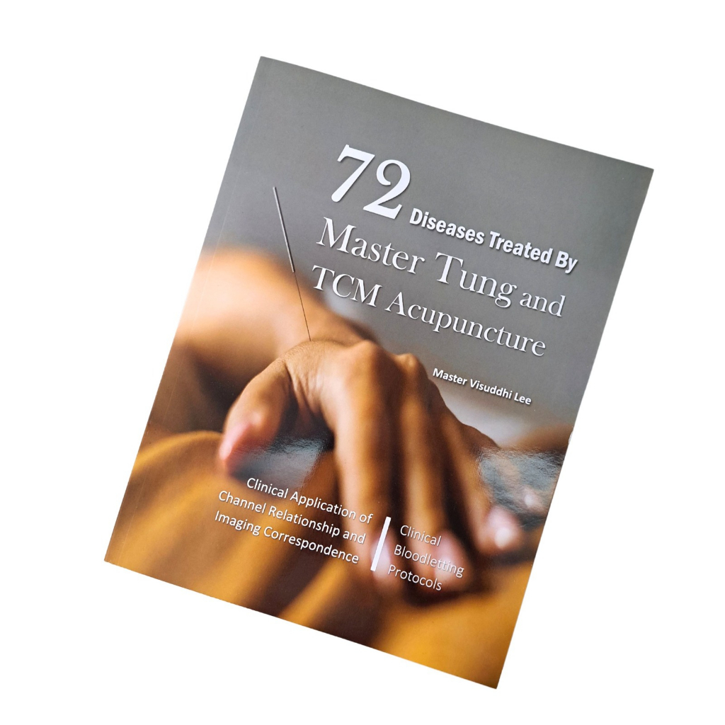Buku Master Tung and TCM Acupuncture [ EDISI 1 & EDISI 2 ] | Shopee ...