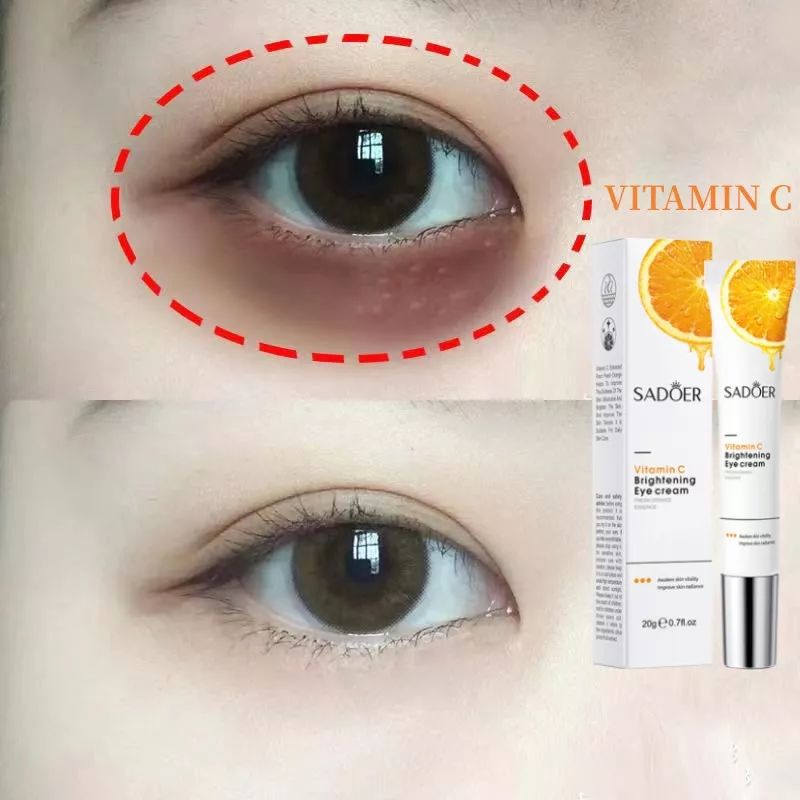 SADOER Vitamin C Brightening Eye Cream 20g Shopee Malaysia