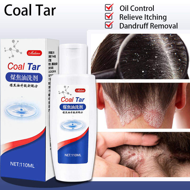 coal tar dandruff shampoo kelemumur psoriasis shampoo kulit kepala ...