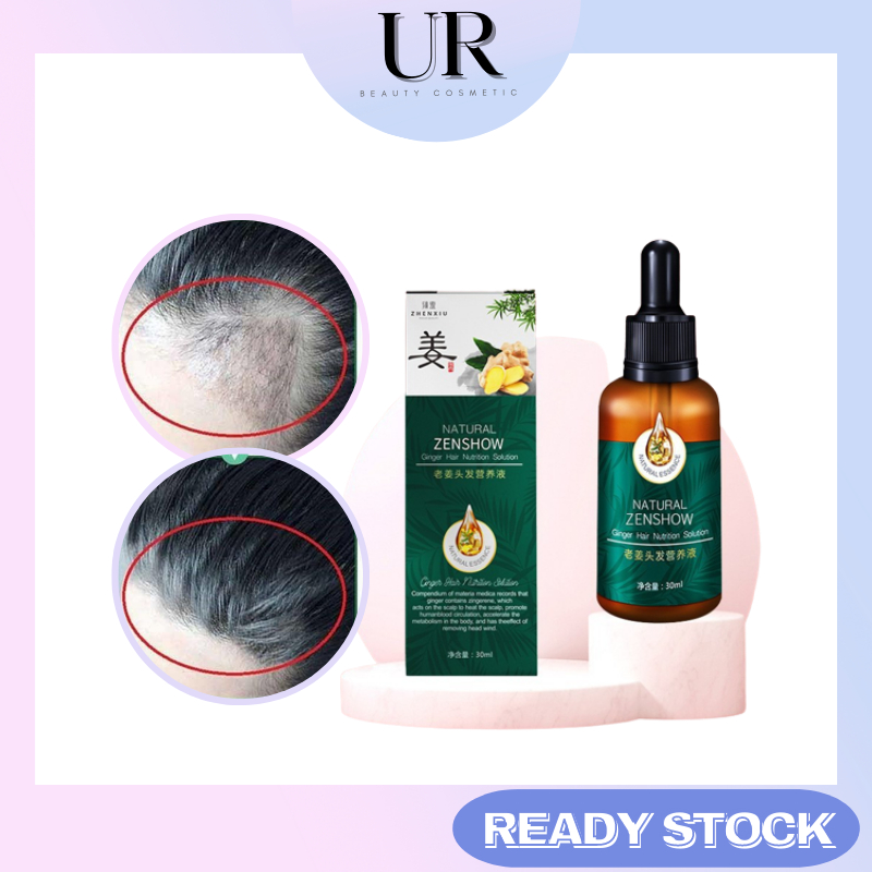 Ginger King Hair Growth Serum Tonic Lebat Rambut Tumbuh rambut gugur
