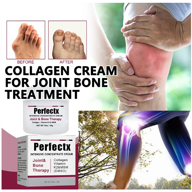 Perfectx Joint And Bone Therapy Cream Treatment Gout Cream Joint Knee ...