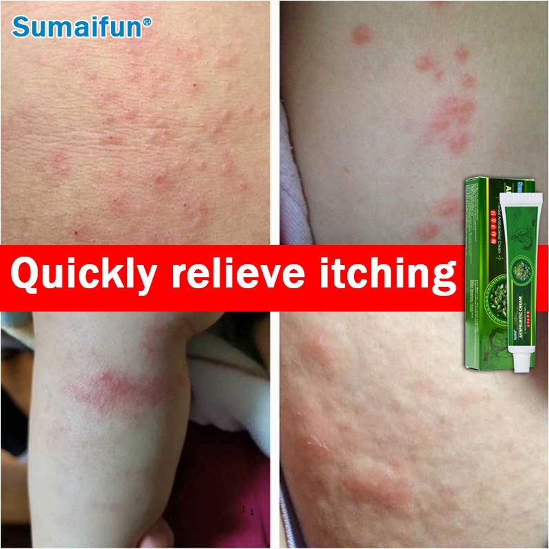 Herbal Cream skin eczema and itching cream skin antibacterial and