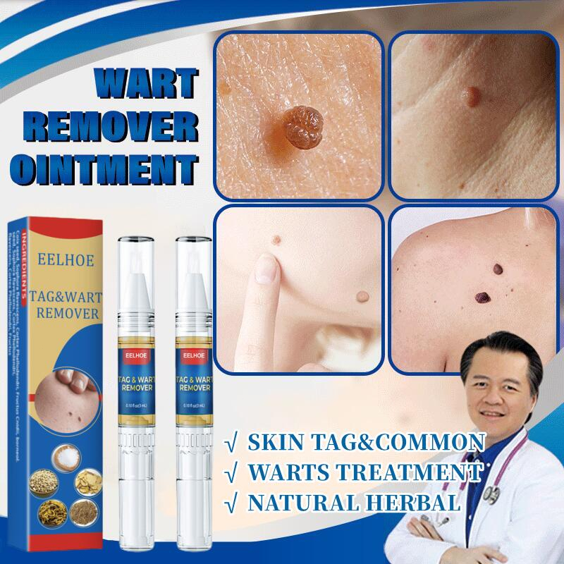 Ubat Ketuat Tahi Lalat Skin Tag Remover Pen Buang Tahi Lalat Dan Kutil Biji Kolestrol Remover