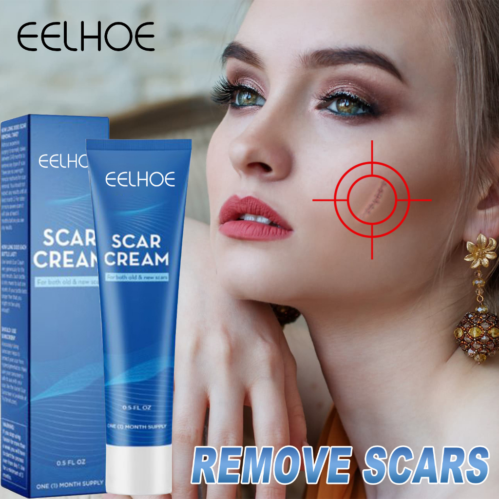 EELHOE Acne Scar Removal Cream (30 g) 淡化疤痕膏 Surgical Scars Stretch