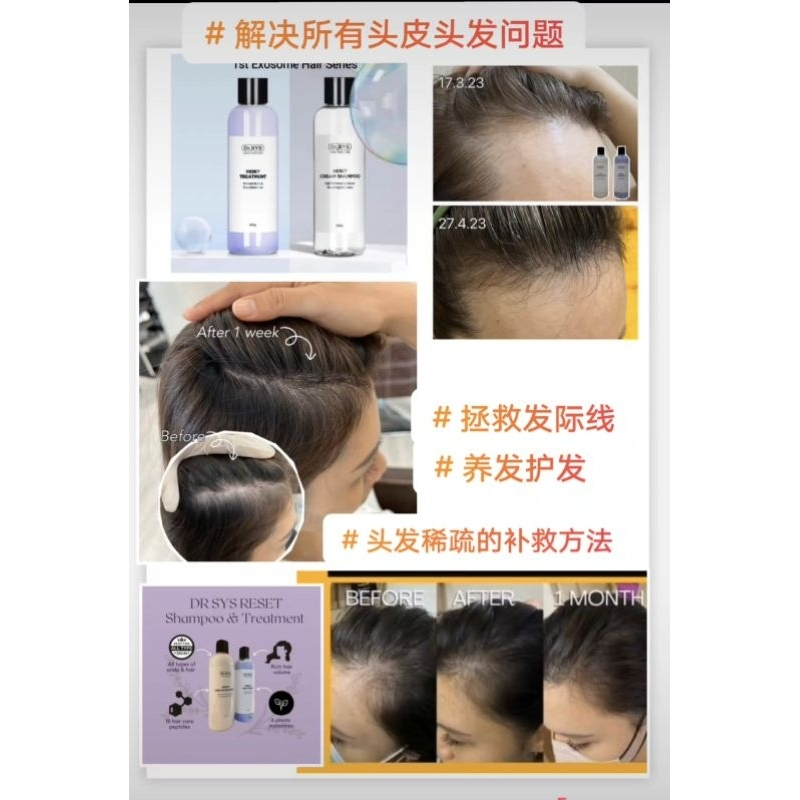 Dr Sys Reset Cream Shampoo & Reset Treatment 500ml Hair Growth