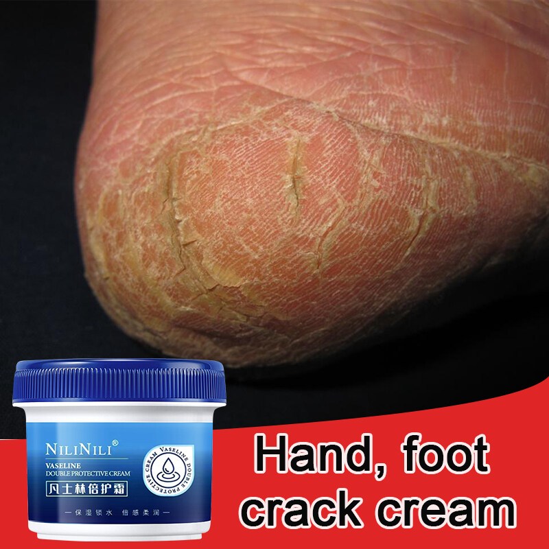 Hydrating Hand Cream 40g Hand and Foot Dry Crack Cream Deep ...