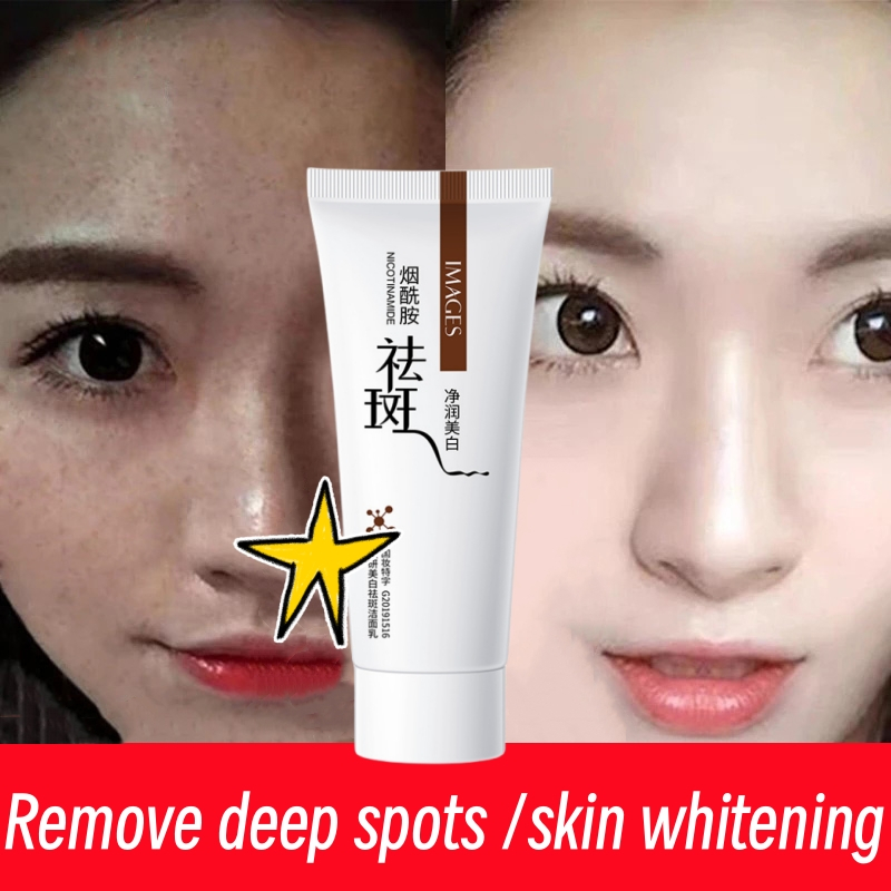 Facial Cleanser Jeragat Degil Berkesan Dark Spot Remover Melasma Ubat