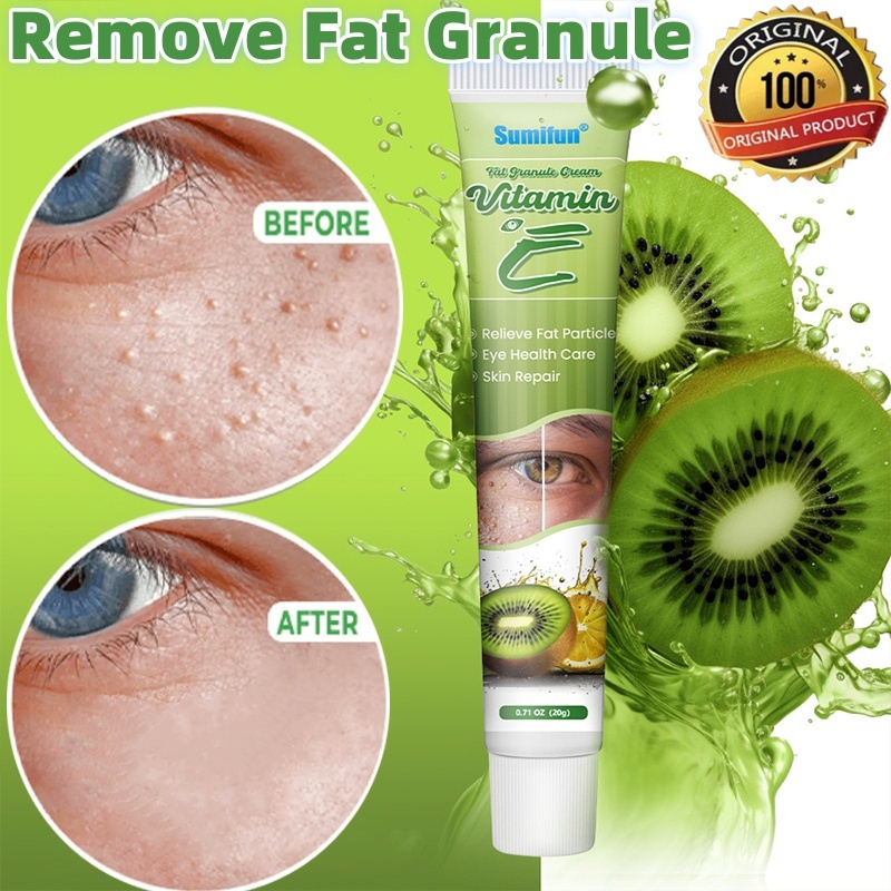 Original vitamin e eye cream fat granule milia seed remover grease