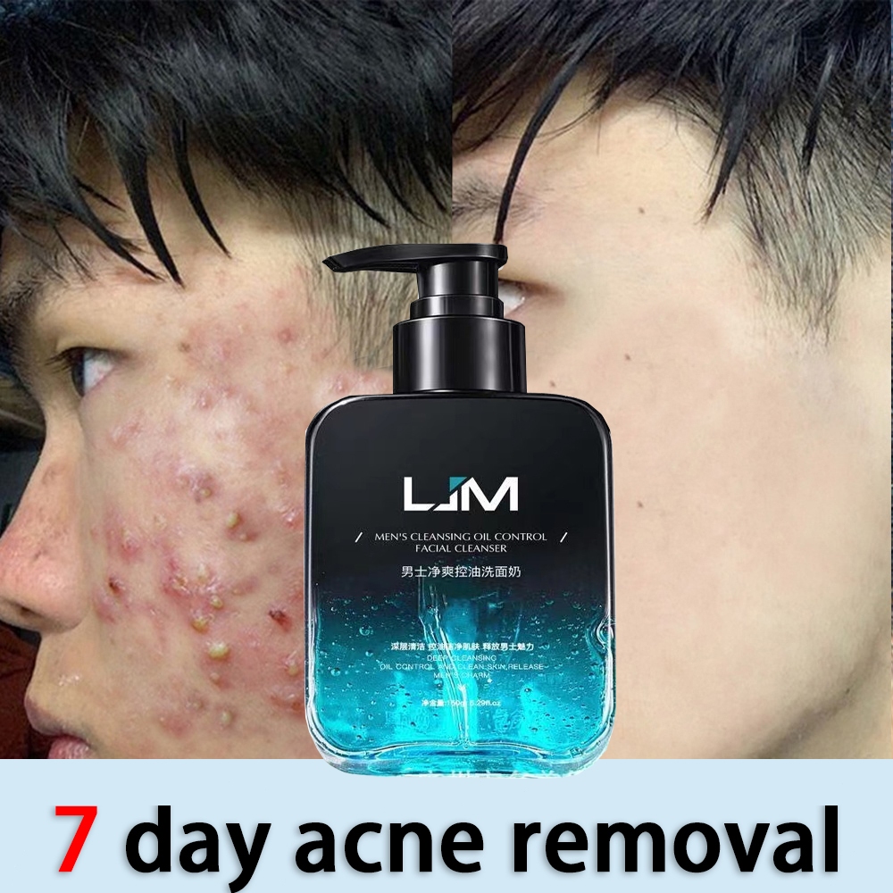 Best Pore Cleanser for Men: Clear Skin with Confidence