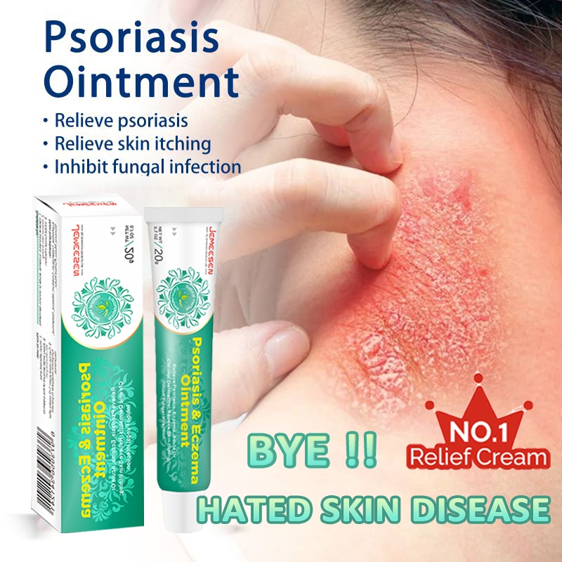 Jemeesen Krim Gatal Kulit Herba Cina Eczema Cream Psoriasis Ointments ...