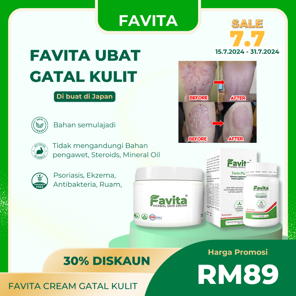 Favita Cream Ubat Sapu Gatal Kulit Untuk Psoriasis Eczema Dan Ruam