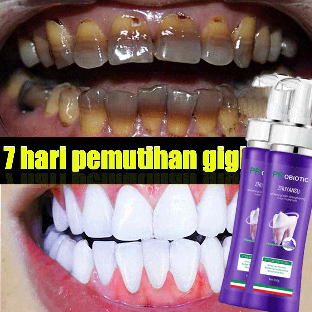Probiotic Toothpaste,Teeth Whitening Probiotic Toothpast, Stain ...