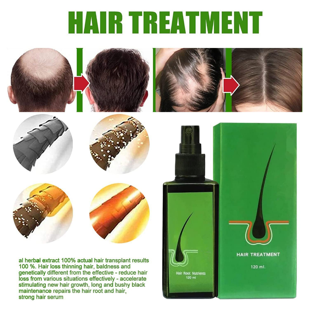 Neo Hair Lotion Hair Treatment Hair Growth Hair 120ml Shopee Malaysia