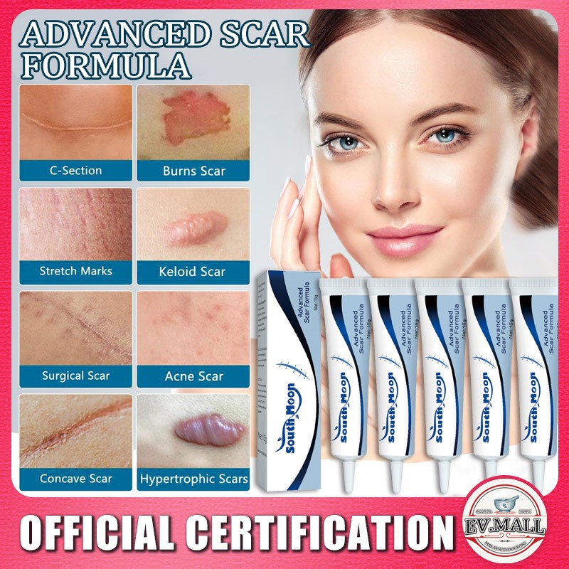 Dermatix advanced scar formula scar removal cream Mosquito Bite Scars