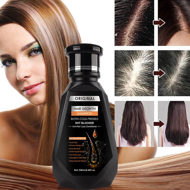 READY STOCK Original ginger hair growth hair loss shampoo dandruff herb ...