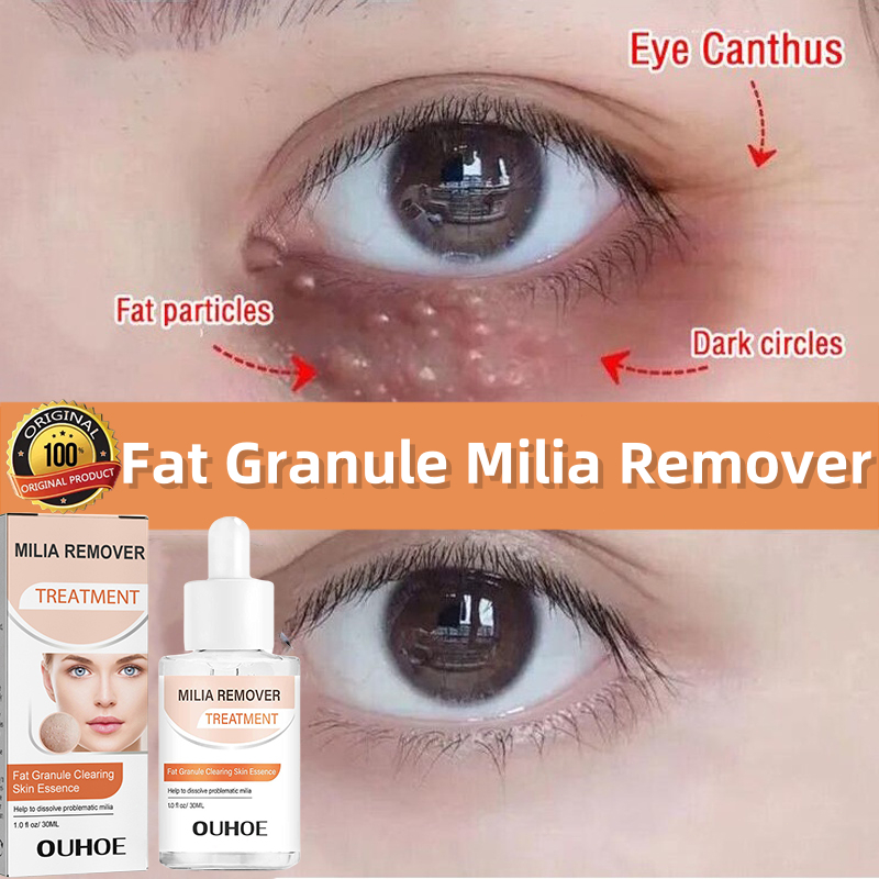 Original Milia seed remover fat granule eye treatment repair serum tiny