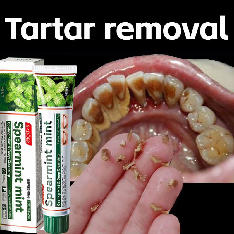 pemutih gigi teeth removal tartar bad breath removal yellow stains 100g ...