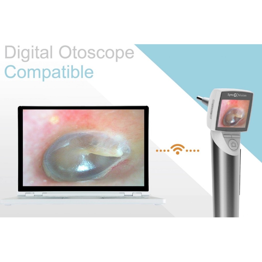 SYNCVISION DIGITAL OTOSCOPE iO1 ELITE Shopee Malaysia