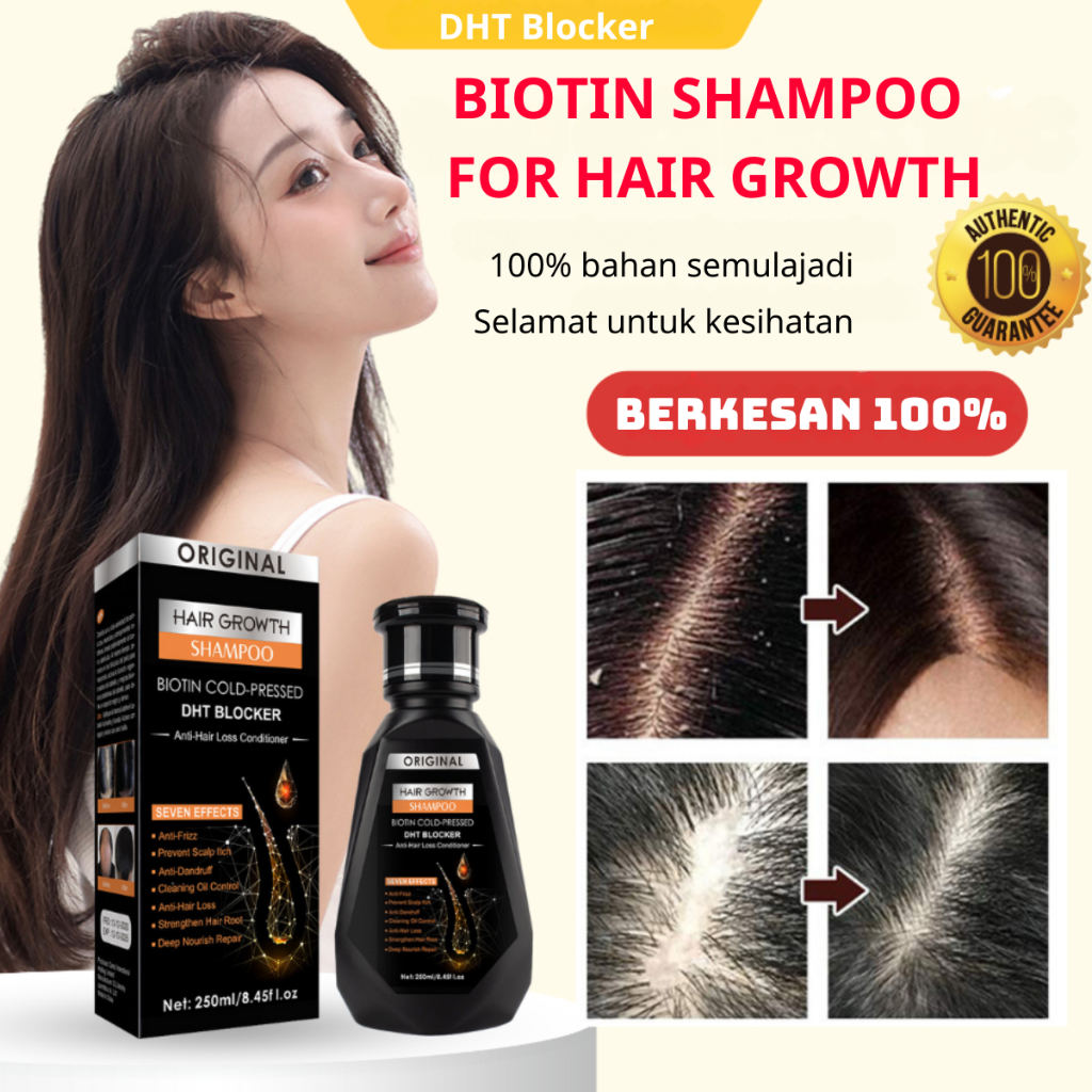 Syampu DHT BLOCKER Merangsang Pertumbuhan Rambut Mengurangkan Kelemumur ...