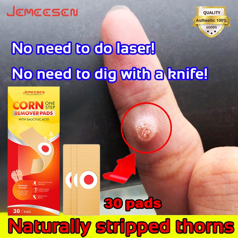 Jemeesen Foot Corn Remover Stickers Painless Medical Plaster Chicken ...