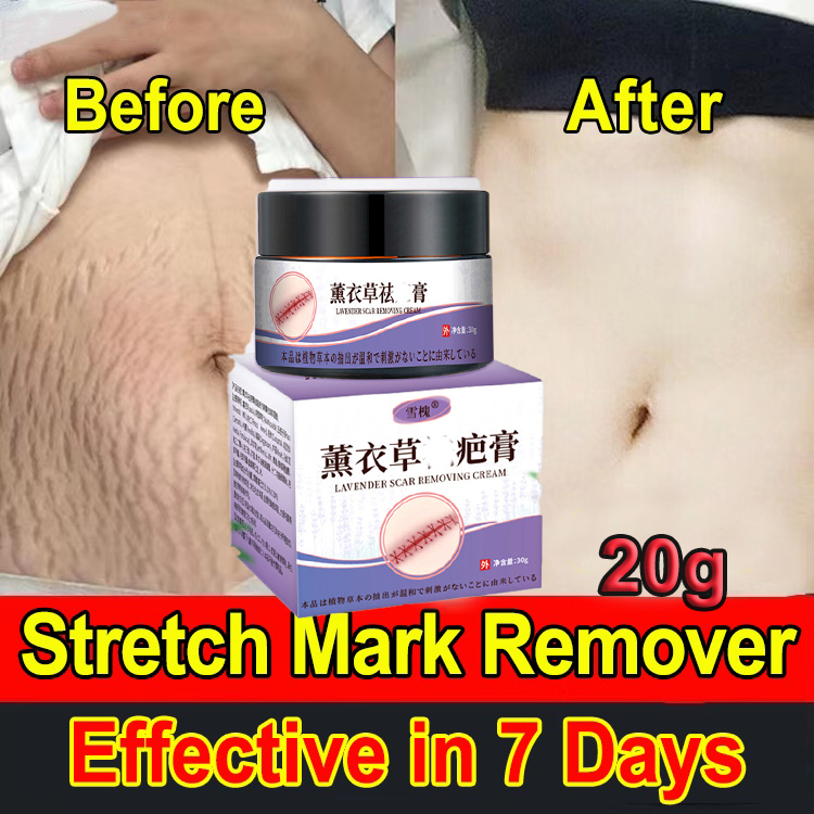 Stretch Mark Repair Cream 20gPregnancy Postpartum Care Anti Wrinkle ...