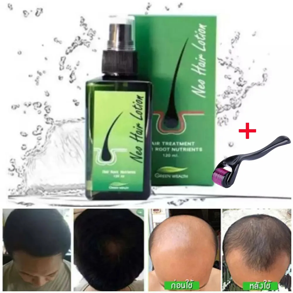 Neo Hair Lotion 120ml With Free Roller Neo Hair Oil Best For The Hair Shopee Malaysia 6945