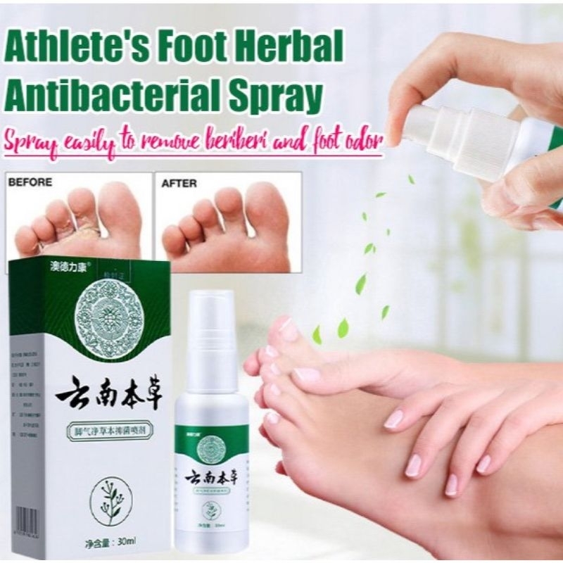 Athlete's Foot Treatment Spray Cures Most Foot Between Toes Rapid ...