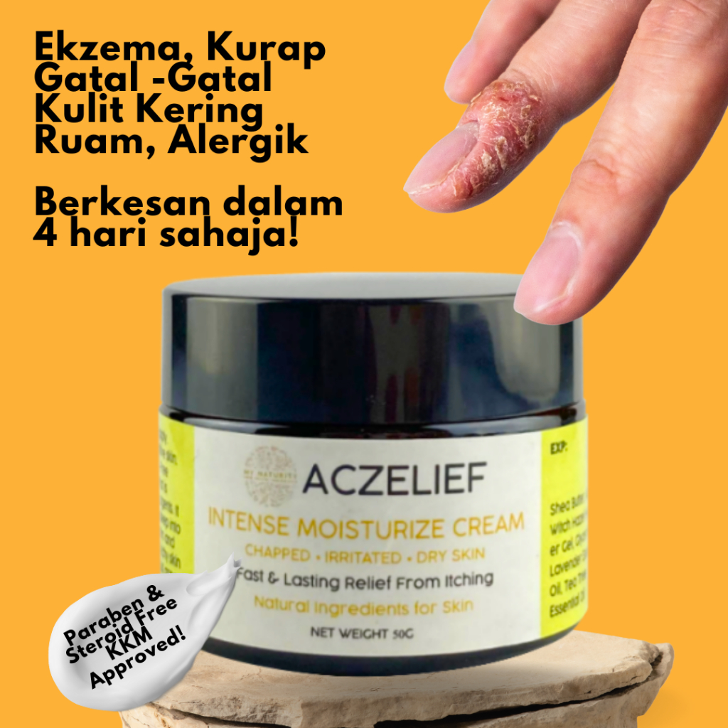 MyNaturity Aczelief Eczema Cream 50g Krim Ekzema Gatal Gatal Kurap