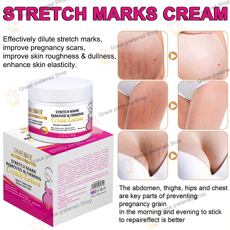 Stretch Marks Removed Firming Cream Maternity Cream 150g Repair Skin ...