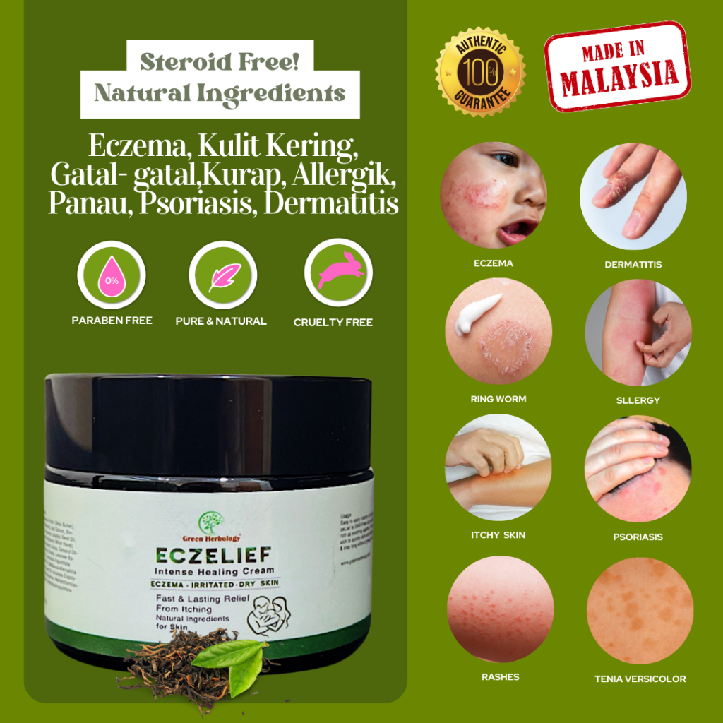 EczeLief Natural Eczema Cream Ekzema, Psoriasis, Gatal Kulit (KKM