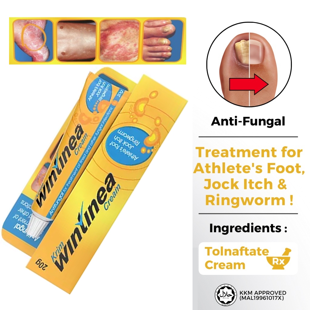 WINTINEA Antifungal Cream 10g ( Tolnaftate For Tinea, Jock Itch & Kurap
