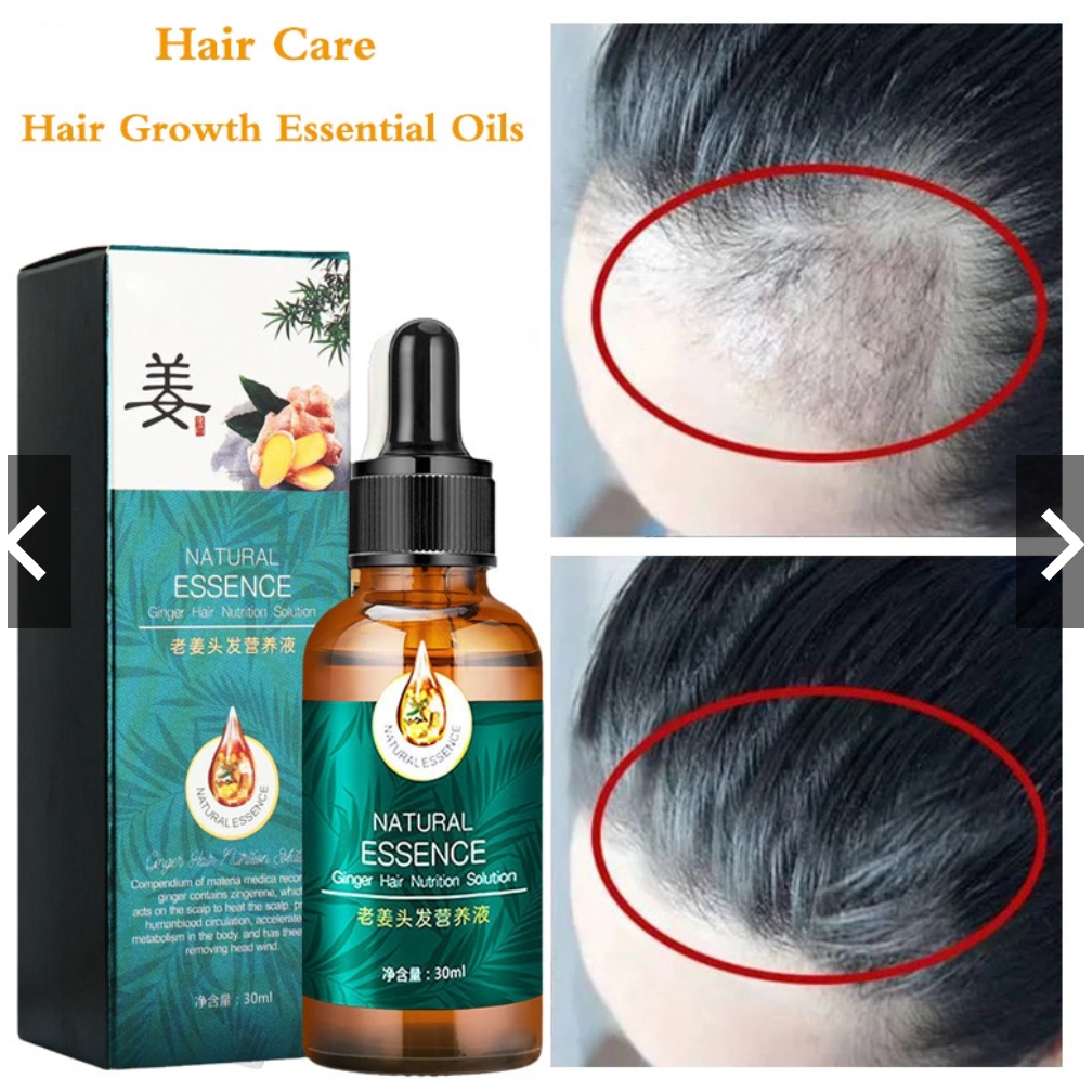 Ginger King Hair Growth Serum Ginger Hair Growth Tonic Tumbuh Rambut