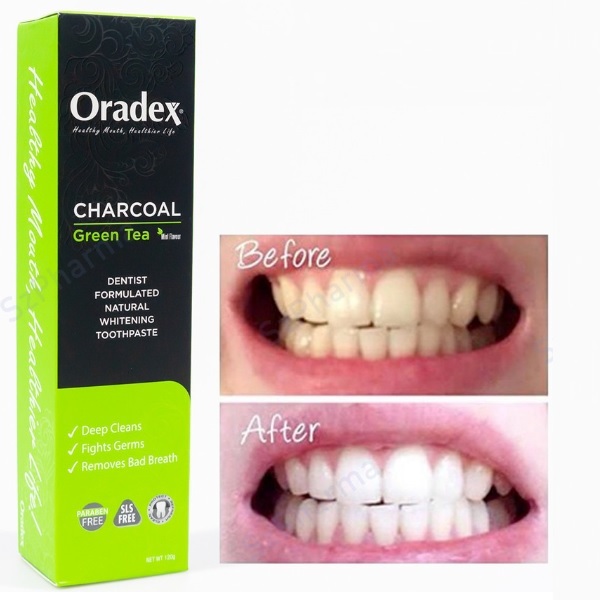 Oradex Charcoal Green Tea Whitening Toothpaste (50g) | Shopee Malaysia