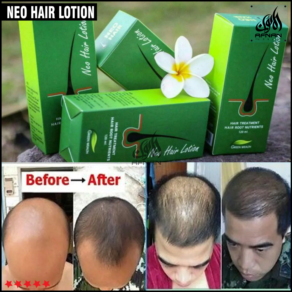 Neo Hair Lotion AntiHair Loss Tonic Hair Treatment Solution Thailand